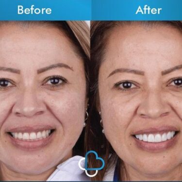 Aesthetic dentistry 
