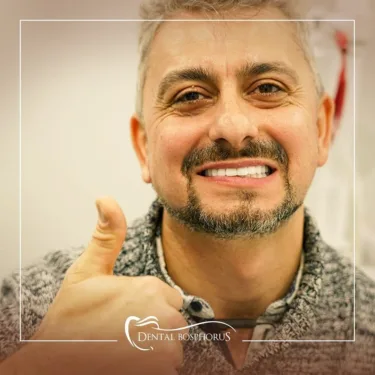 Голливудская улыбка