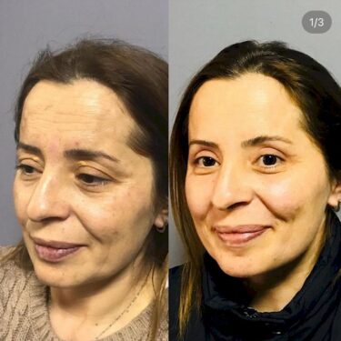 Plastische Gesichtschirurgie