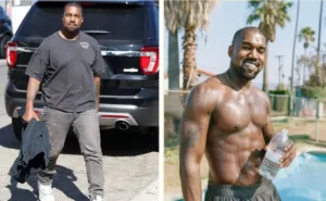 Kanye West tummy tuck
