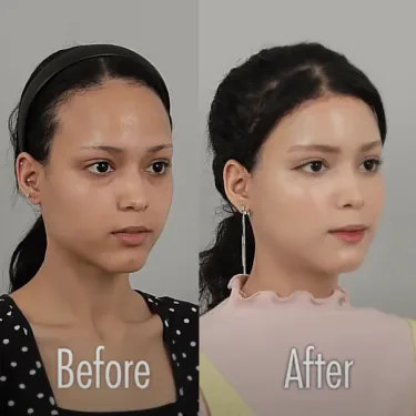 Facial contouring