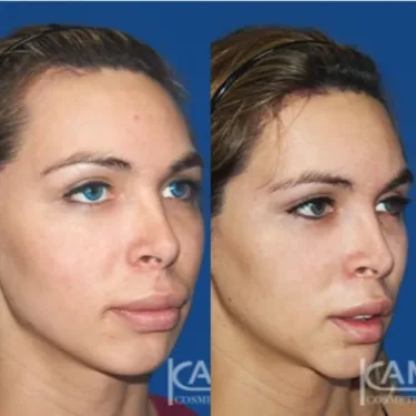 Изменение пола (из мужчины в женщину)