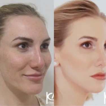 Изменение пола (из мужчины в женщину)