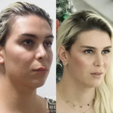 Изменение пола (из мужчины в женщину)