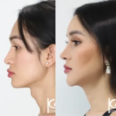 Изменение пола (из мужчины в женщину)