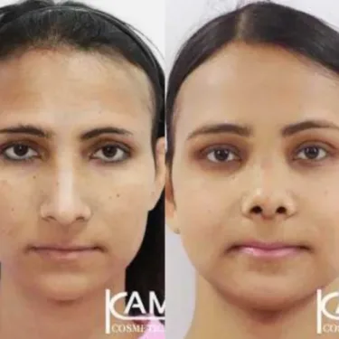 Изменение пола (из мужчины в женщину)