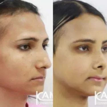 Изменение пола (из мужчины в женщину)