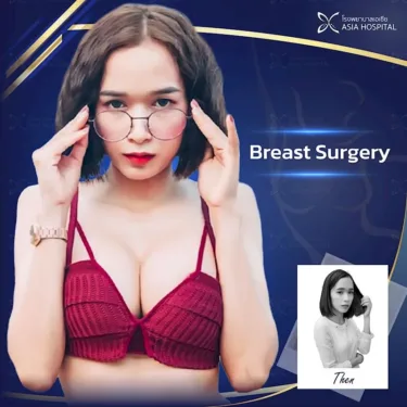 Breast augmentation