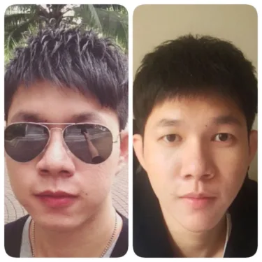 Anti-aging, dermato-cosmetic procedures