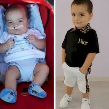 Расщелина губы и мягкого неба