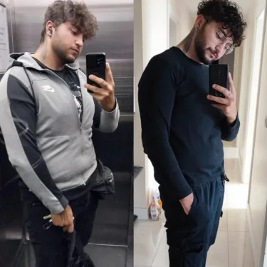 Bariatric surgery for weight loss