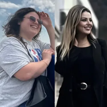 Bariatric surgery for weight loss