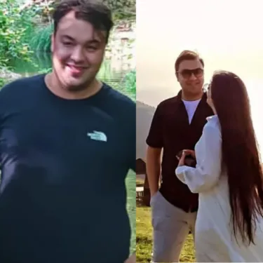 Bariatric surgery for weight loss