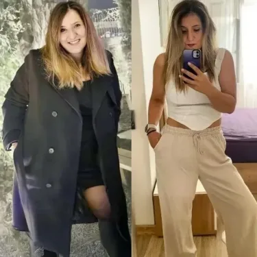 Bariatric surgery for weight loss