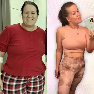 Bariatric surgery for weight loss