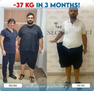 Шунтирование желудка в Турции у доктора Недждета Деричи