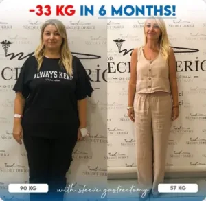 Рукавная гастропластика в Турции у доктора Недждета Деричи