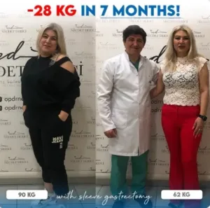 Бариатрическая операция для похудения в Турции у доктора Недждета Деричи