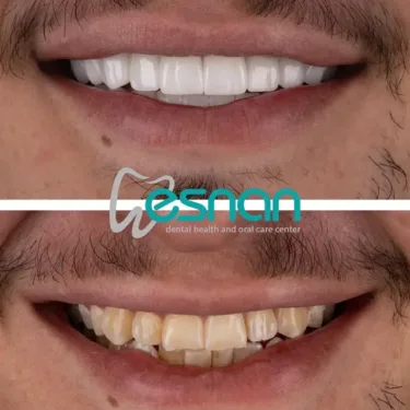 Aesthetic Dentistry