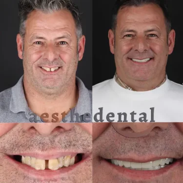 Aesthetic Dentistry