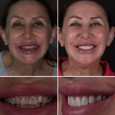 Aesthetic Dentistry