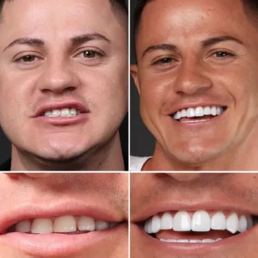 Aesthetic Dentistry