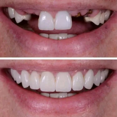 Aesthetic Dentistry