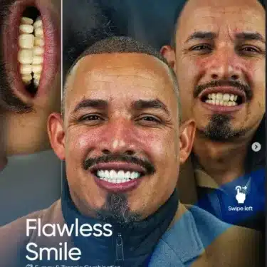 Hollywood Smile