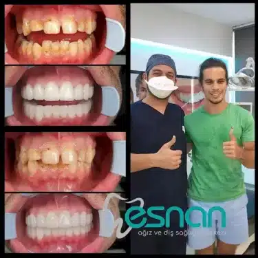 Dentisterie esthétique
