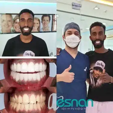 Dentisterie esthétique