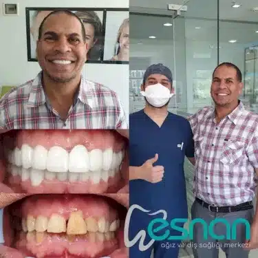Dentisterie esthétique