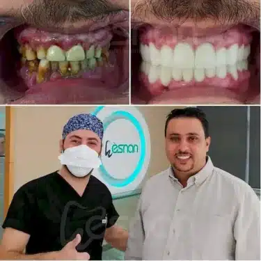 Dentisterie esthétique