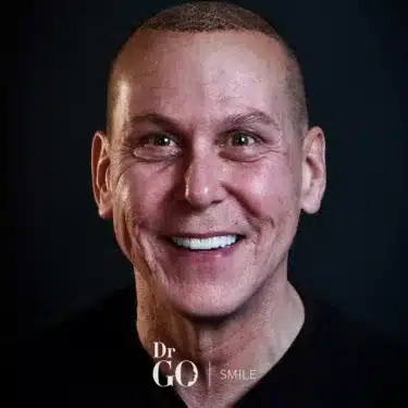 Sonrisa de Hollywood