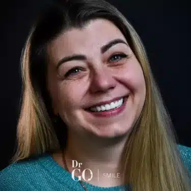Sonrisa de Hollywood