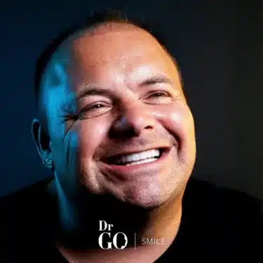 Sonrisa de Hollywood
