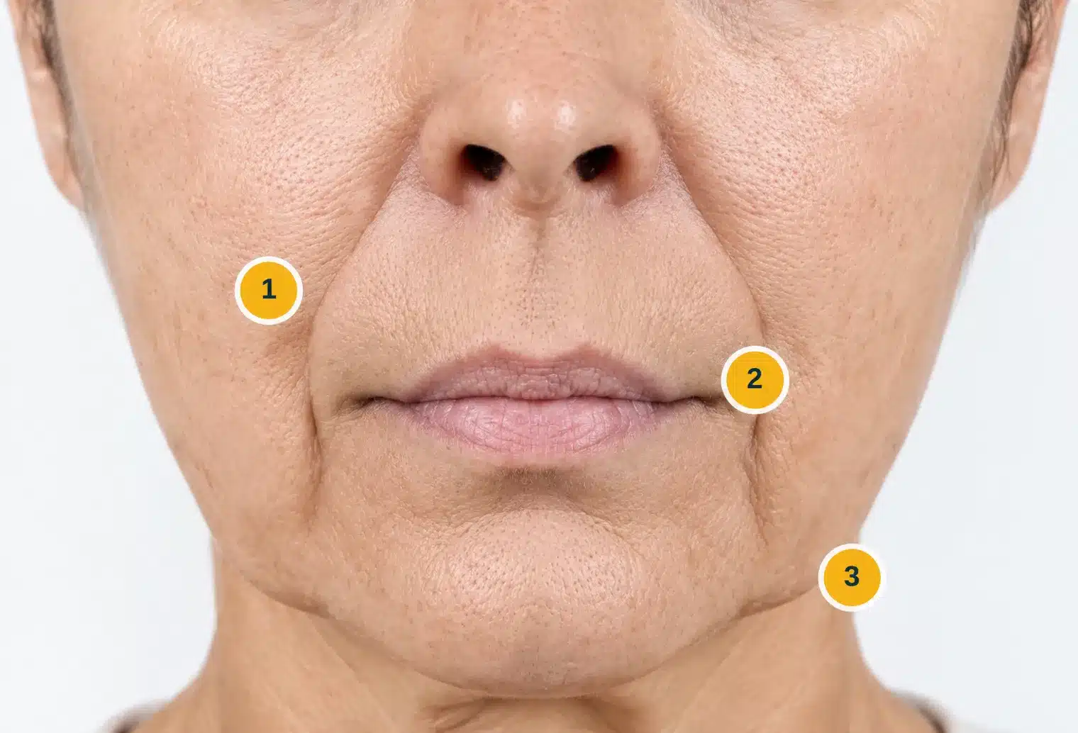 Areas of age-related facial changes
