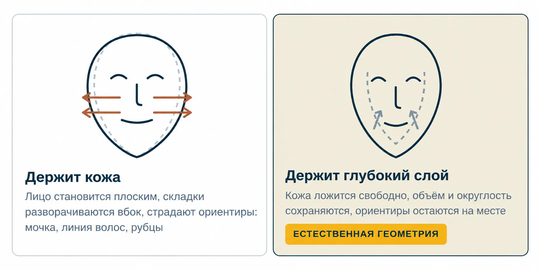 Натяжение кожи и поддержка глубоких тканей при фейслифтинге