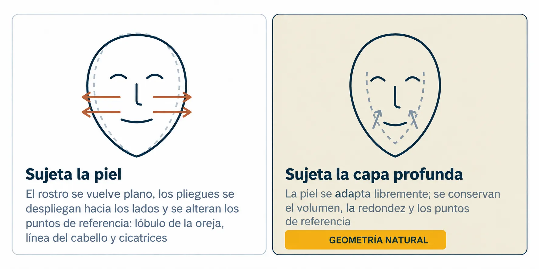Tensión de la piel y soporte de los tejidos profundos en un lifting facial