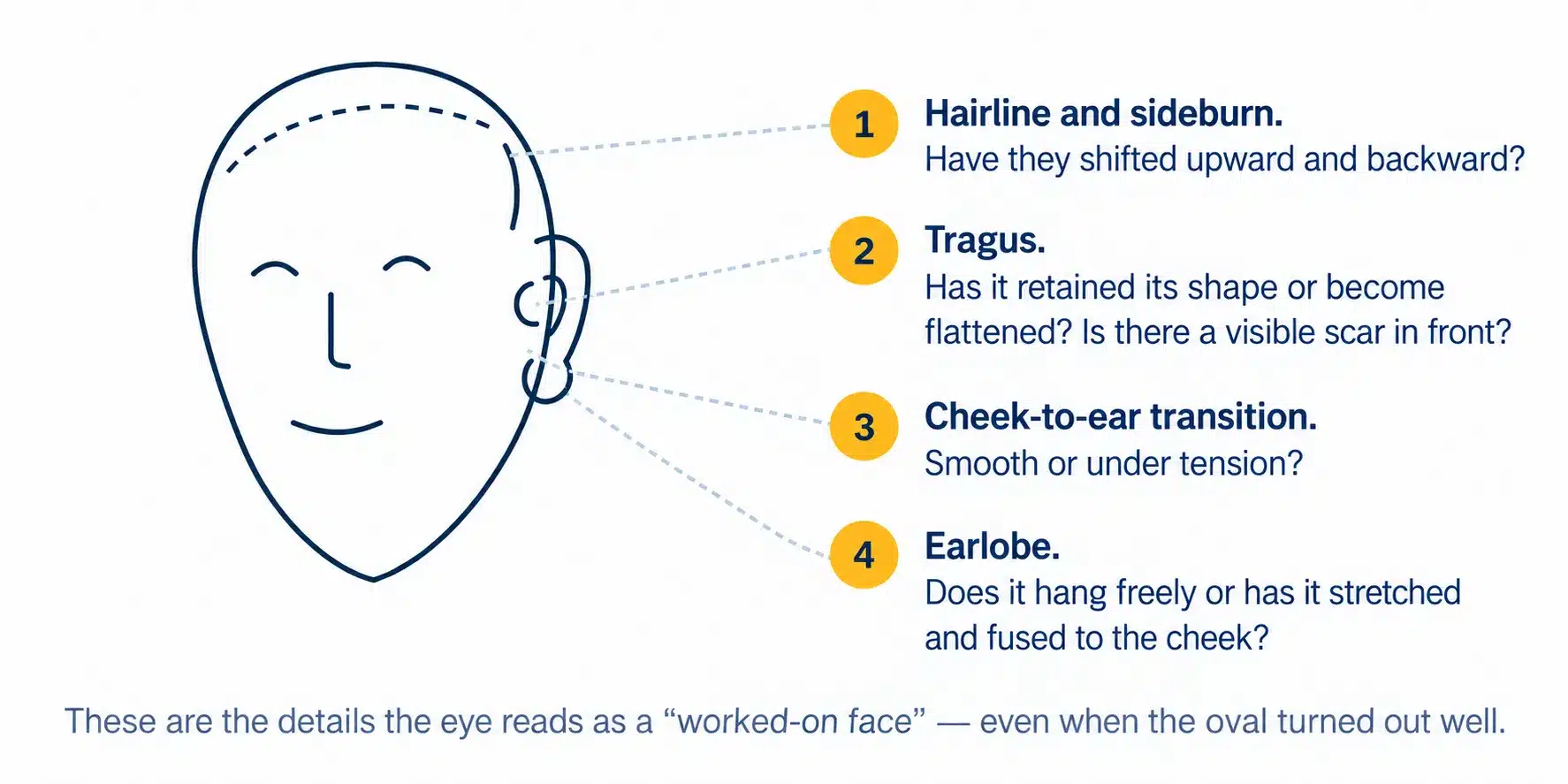Facial details that may reveal a facelift result