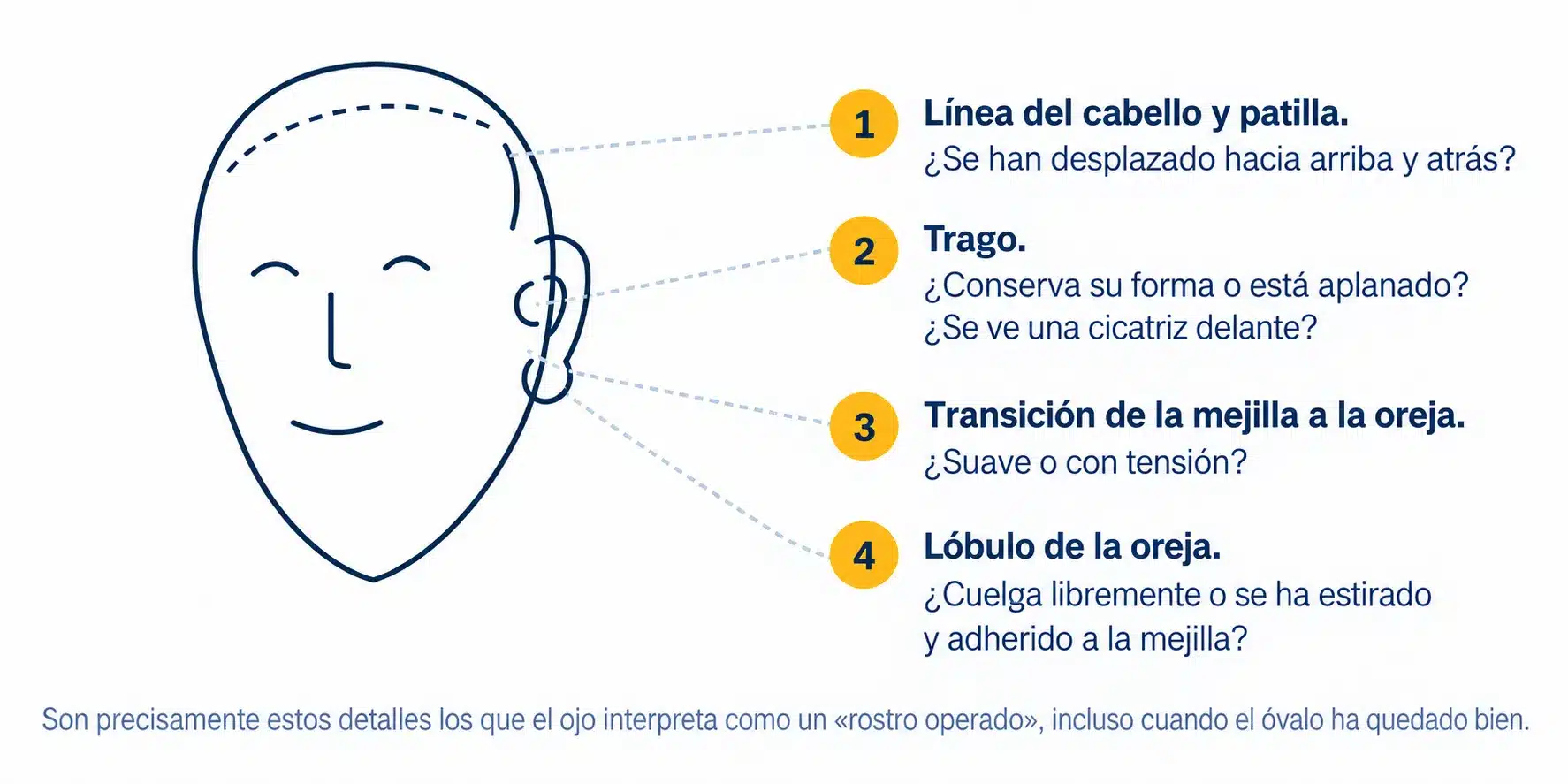 Detalles faciales que pueden revelar el resultado de un lifting