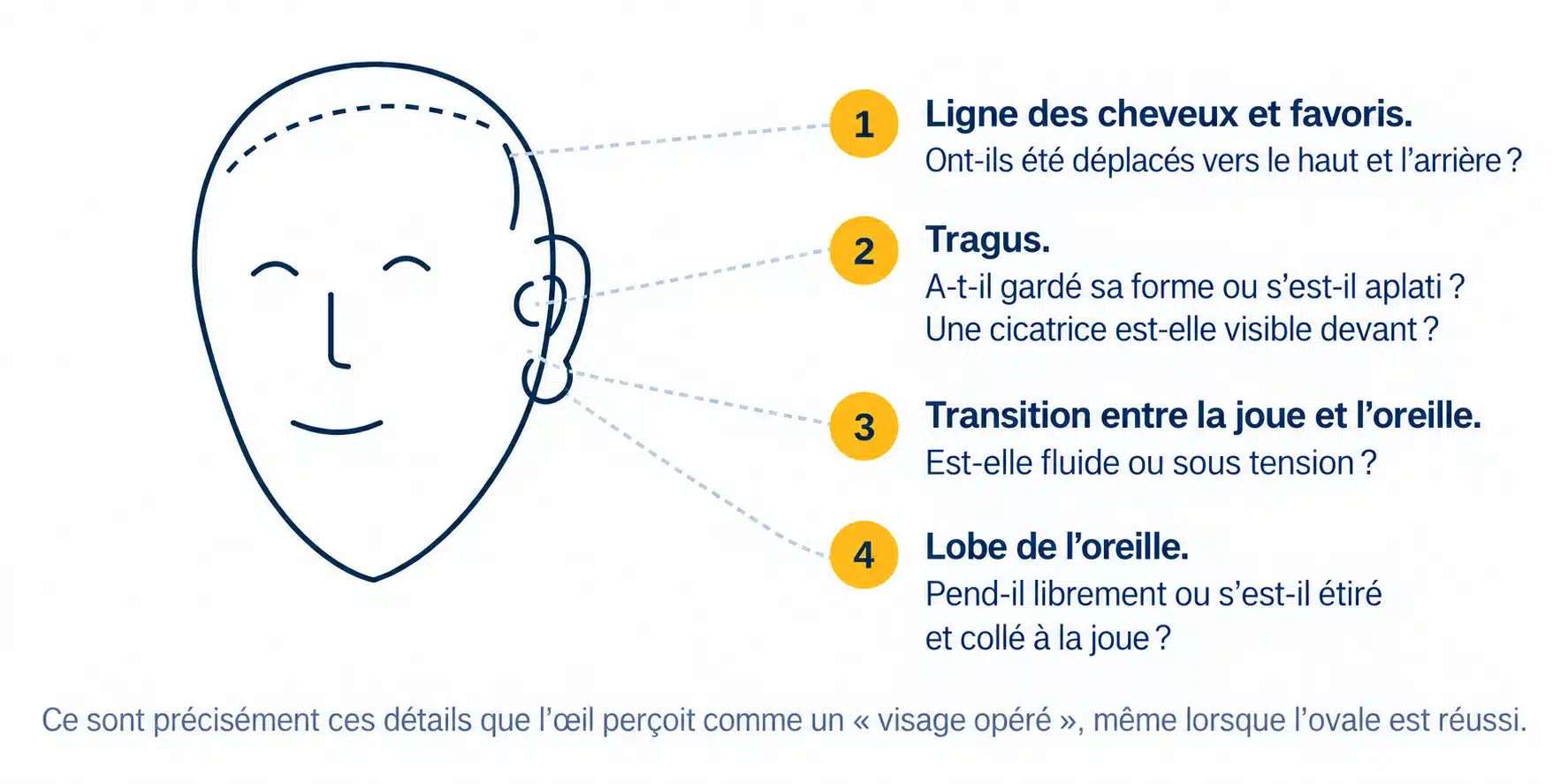 Détails du visage susceptibles de révéler le résultat d’un lifting